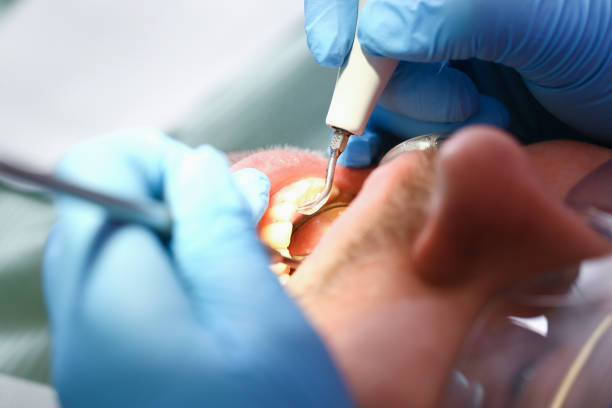 Best Emergency Root Canal Treatment in Darien, WI